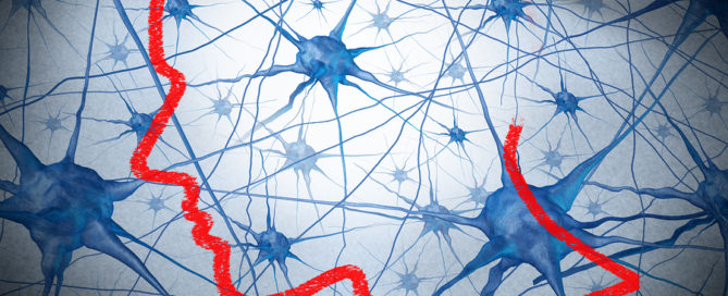 Neurology research concept graphic